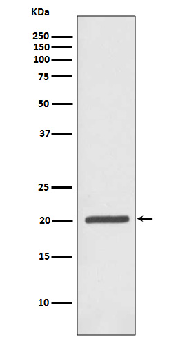 Rabbit Polyclonal Antibody to Ferritin Heavy Chain