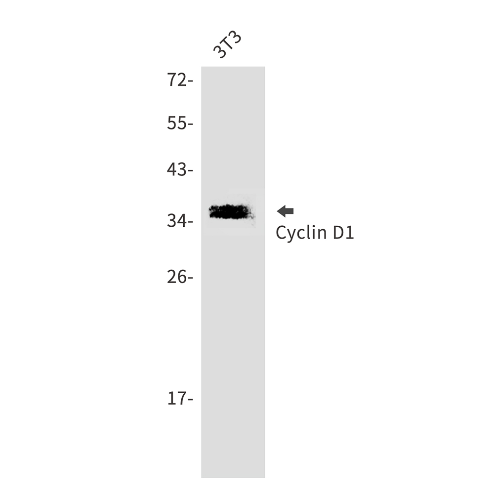 Rabbit Polyclonal Antibody to Cyclin D1