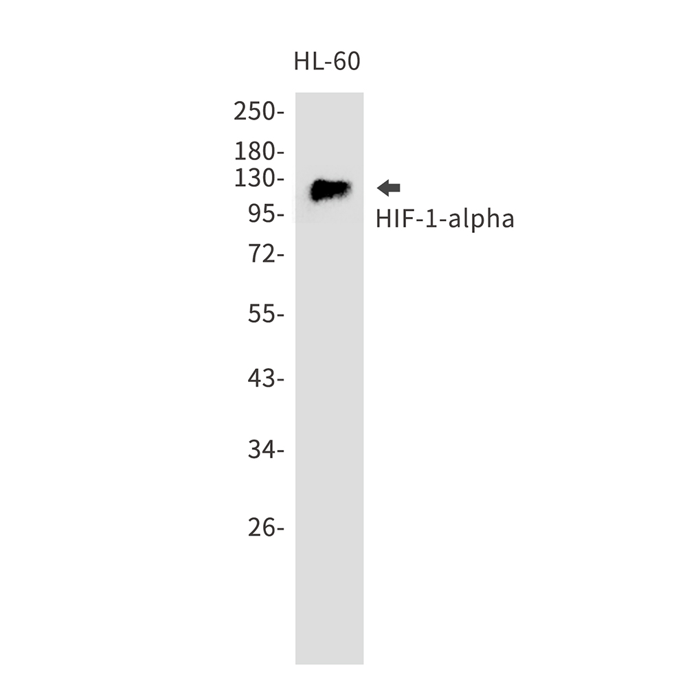 Rabbit Polyclonal Antibody to HIF1 alpha
