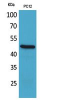 Rabbit Polyclonal Antibody to FOXP3