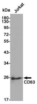 Rabbit Polyclonal Antibody to CD63