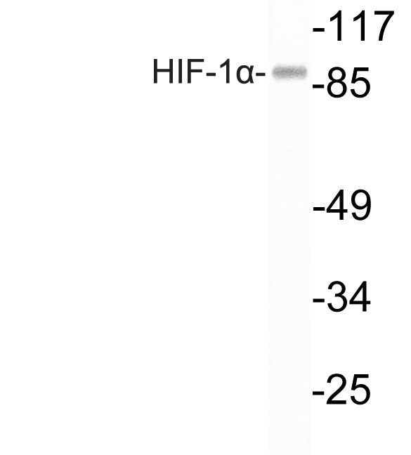 Rabbit Polyclonal Antibody to HIF1 alpha
