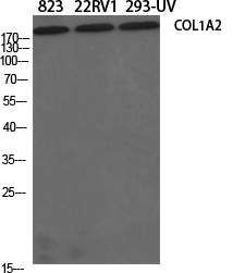 Rabbit Polyclonal Antibody to Collagen I alpha 2