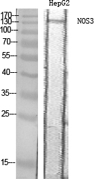 Rabbit Polyclonal Antibody to eNOS