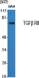 Rabbit Polyclonal Antibody to TGF beta Receptor II