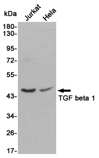 Rabbit Polyclonal Antibody to TGF beta 1