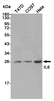 Rabbit Polyclonal Antibody to IL-6