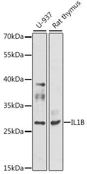 Rabbit Polyclonal Antibody to IL-1 beta