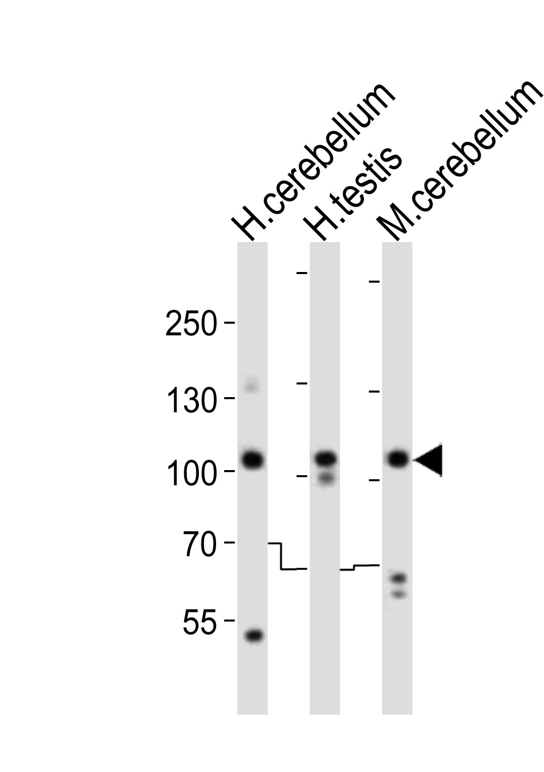 Rabbit Polyclonal Antibody to SKOR2