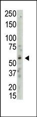 Rabbit Polyclonal Antibody to PRMT3