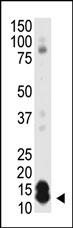 Rabbit Polyclonal Antibody to SUMO1 (N-term)