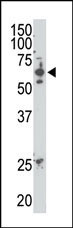 Rabbit Polyclonal Antibody to SENP2