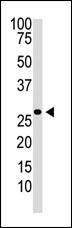 Rabbit Polyclonal Antibody to DKK2 (N-term)