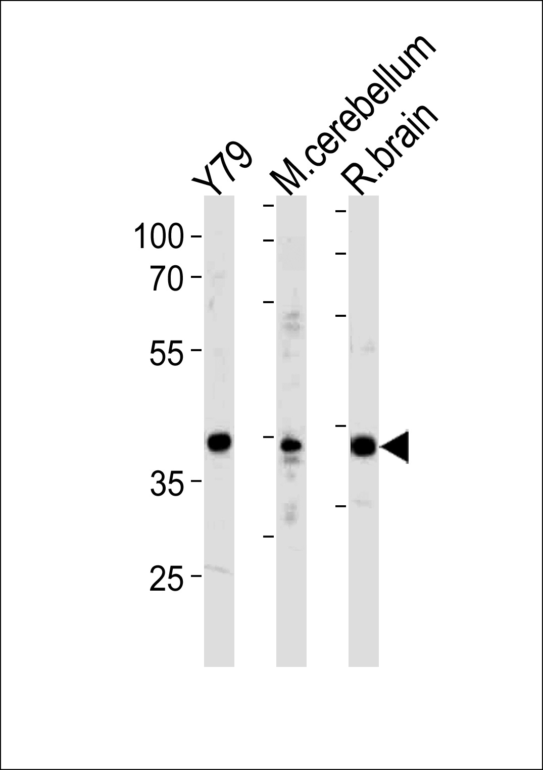 Rabbit Polyclonal Antibody to NeuroD1