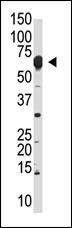 Rabbit Polyclonal Antibody to NYREN18 (N-term)