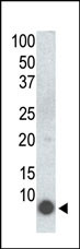 Mouse Monoclonal Antibody to Phospho-PLM(S68)