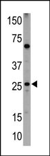 Rabbit Polyclonal Antibody to NIP1 (BH3 Domain Specific)