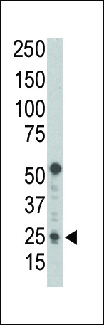 Rabbit Polyclonal Antibody to Puma BH3 Domain