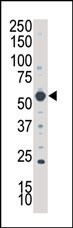 Rabbit Polyclonal Antibody to SGK3 (N-term)