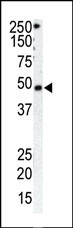 Rabbit Polyclonal Antibody to GRK1