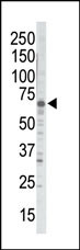 Rabbit Polyclonal Antibody to GRK5