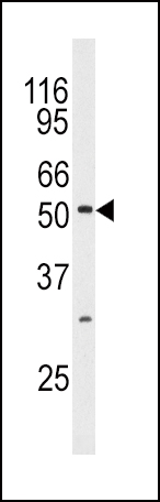 Rabbit Polyclonal Antibody to MAPK10 (N-term)