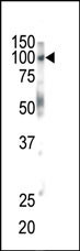 Rabbit Polyclonal Antibody to EphB1