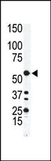 Rabbit Polyclonal Antibody to ILK1/ILK2 (N-term)