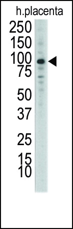 Rabbit Polyclonal Antibody to DDR1 (N-term)
