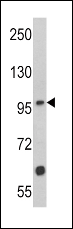 Rabbit Polyclonal Antibody to MUSK (N-term)