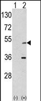 Rabbit Polyclonal Antibody to AIK (N-term)