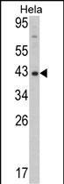 Rabbit Polyclonal Antibody to Mouse Dnmt3L