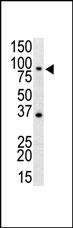 Rabbit Polyclonal Antibody to M TLR4 (N-term)