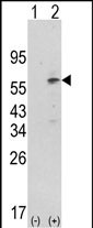 Rabbit Polyclonal Antibody to PDK1 (N-term)