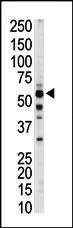 Rabbit Polyclonal Antibody to PKLR