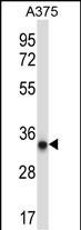 Rabbit Polyclonal Antibody to AMPK beta2 (PRKAB2) (N-term)
