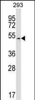 Rabbit Polyclonal Antibody to MAPK10 (N-term)