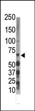 Rabbit Polyclonal Antibody to DYRK3 (N-term)