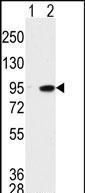 Rabbit Polyclonal Antibody to MAK