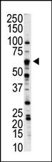 Rabbit Polyclonal Antibody to NLK