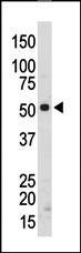 Rabbit Polyclonal Antibody to SRMS