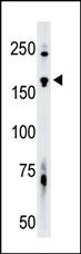 Rabbit Polyclonal Antibody to TNIK (N-term)