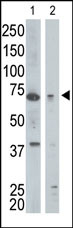 Rabbit Polyclonal Antibody to GGA1 (N-term)