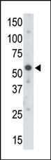 Rabbit Polyclonal Antibody to UBE1C