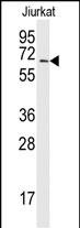 Rabbit Polyclonal Antibody to SAE2 (UBA2) (C-term E616)