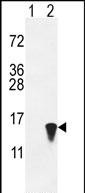 Rabbit Polyclonal Antibody to ISG15 (N-term)