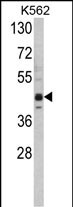 Rabbit Polyclonal Antibody to SET07
