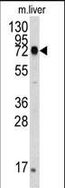 Rabbit Polyclonal Antibody to HSPA5