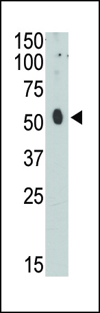 Rabbit Polyclonal Antibody to CEM15 (N-term)
