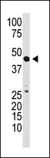 Rabbit Polyclonal Antibody to GDF3 (N-term)